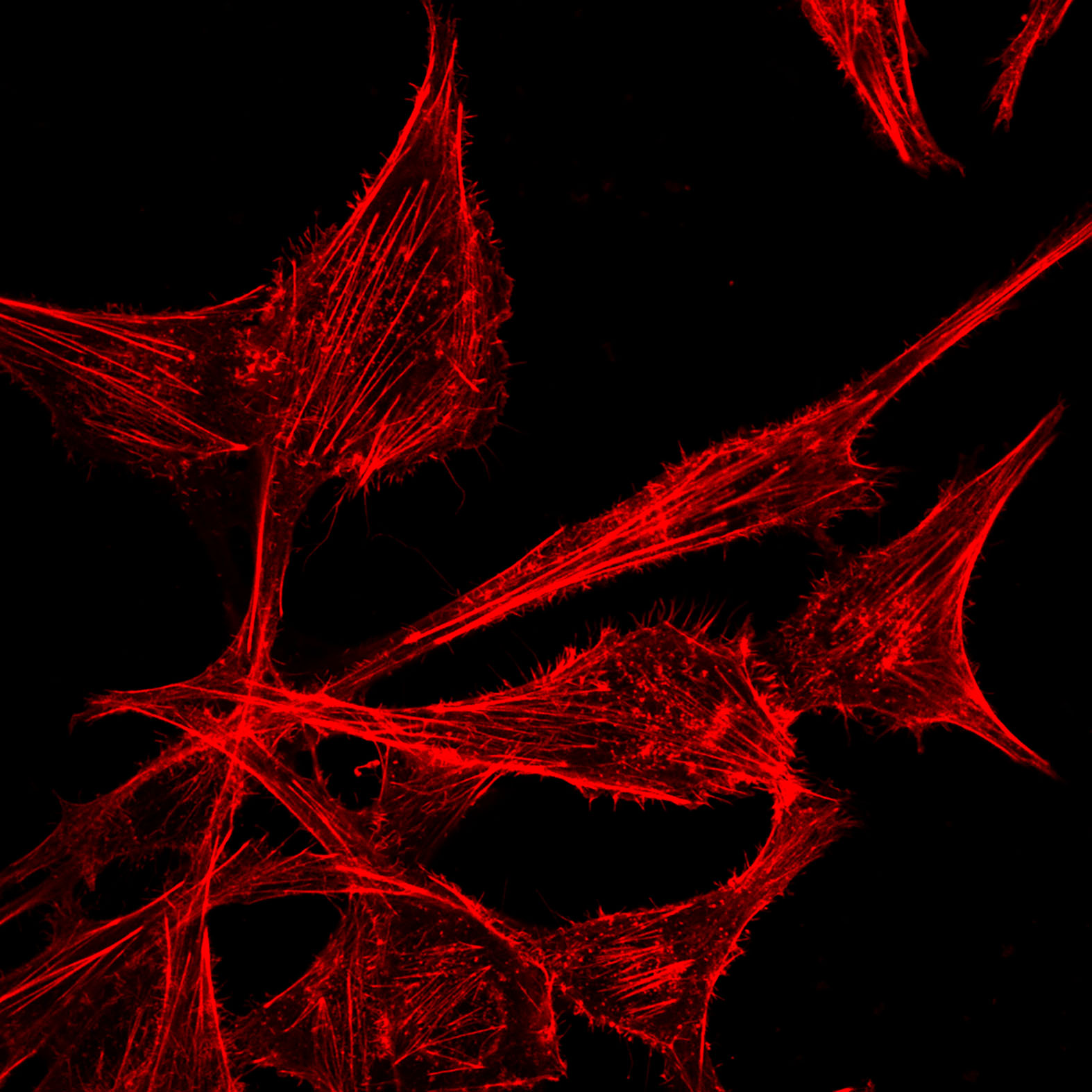 Ischemia_Illustration